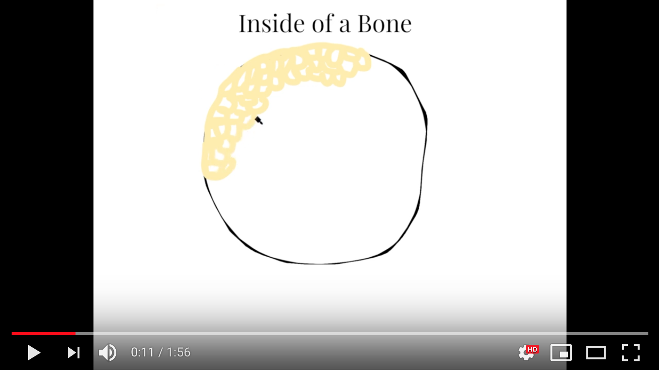 Osteoporosis – The Breakdown of Healthy Bone (Miranda Lally)