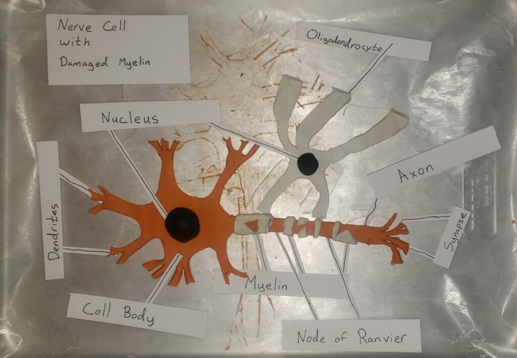 Multiple Sclerosis and the Nervous system – Human STEAM