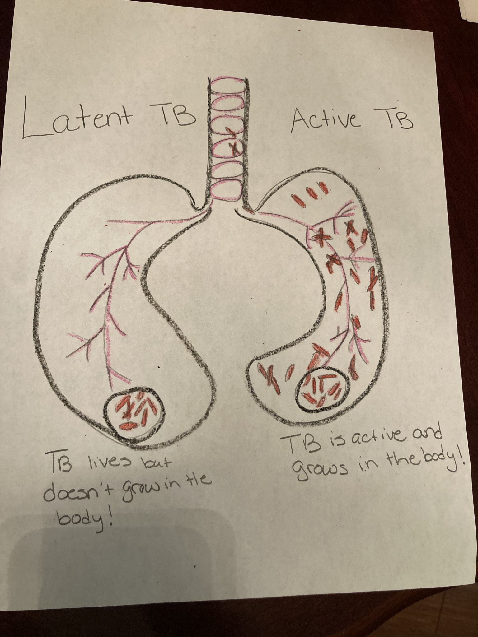 latent-vs-active-tb-human-steam