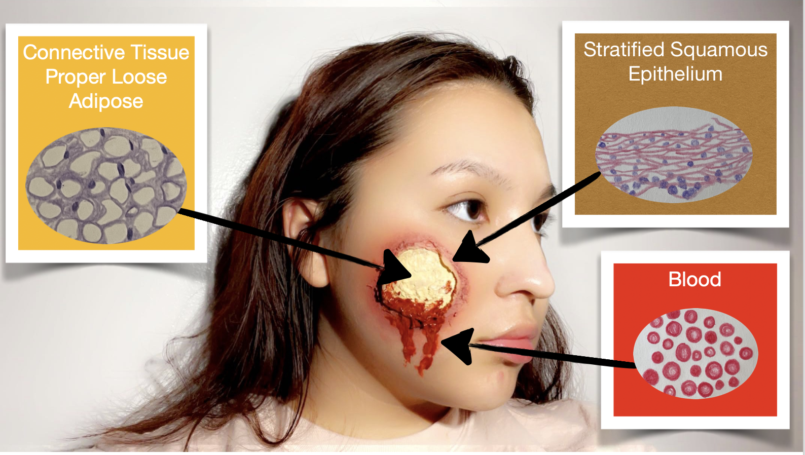 Healing Facial Wound Using Skin Grafts Human STEAM