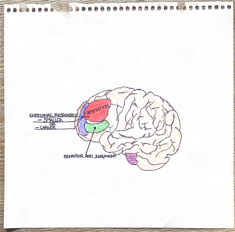 BIPOLAR DISORDER AND THE BRAIN. – Human STEAM