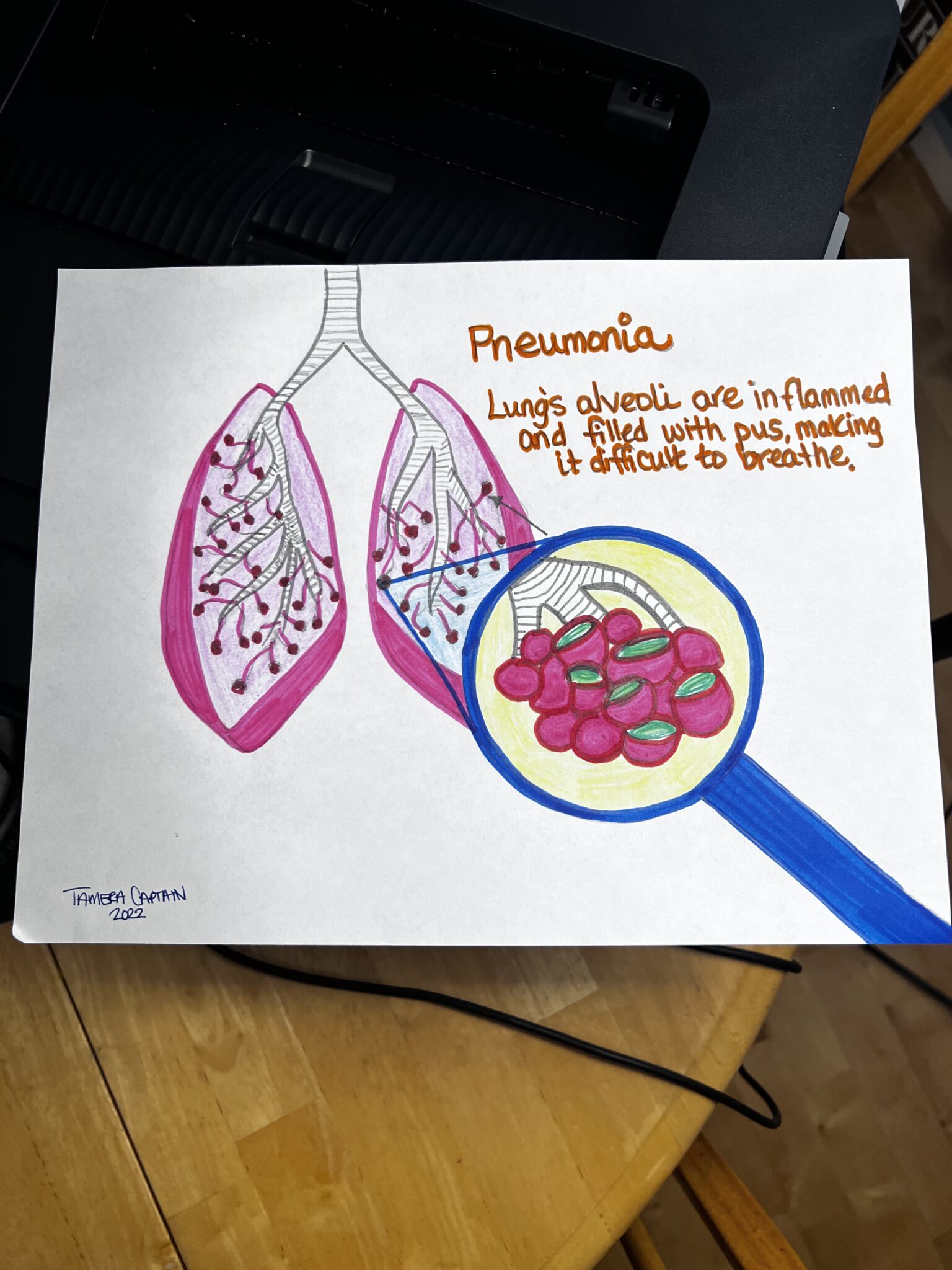 Effects pneumonia has on the lungs – Human STEAM