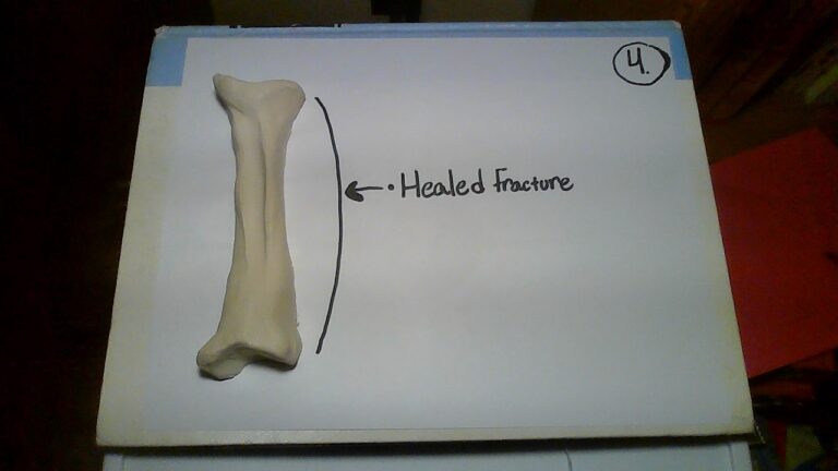 Healing Broken Bones: The Stages of Bone Development and Repair – Human ...