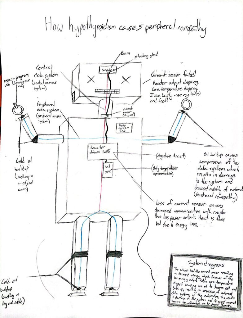 How Hypothyroidism Causes Peripheral Neuropathy Human STEAM