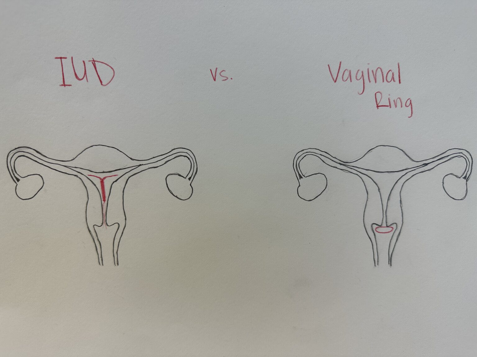 iud-versus-vaginal-ring-birth-control-human-steam