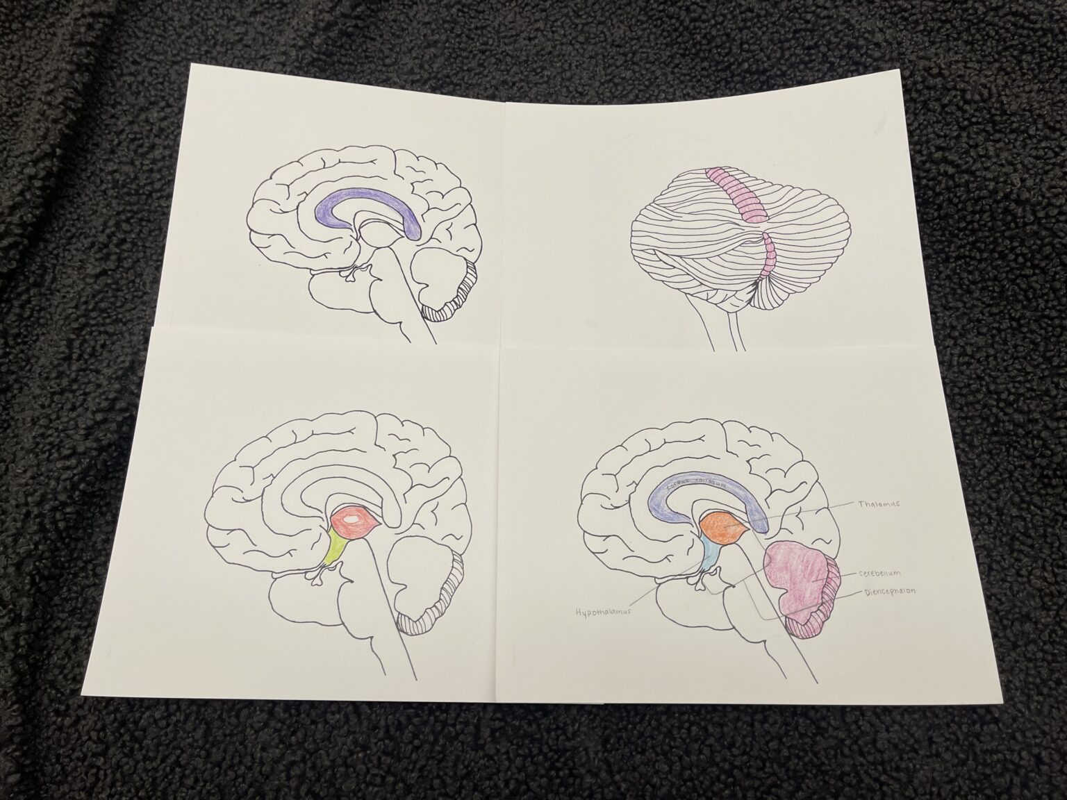 Fetal Alcohol Syndrome (FAS) effect on child’s developing brain – Human ...