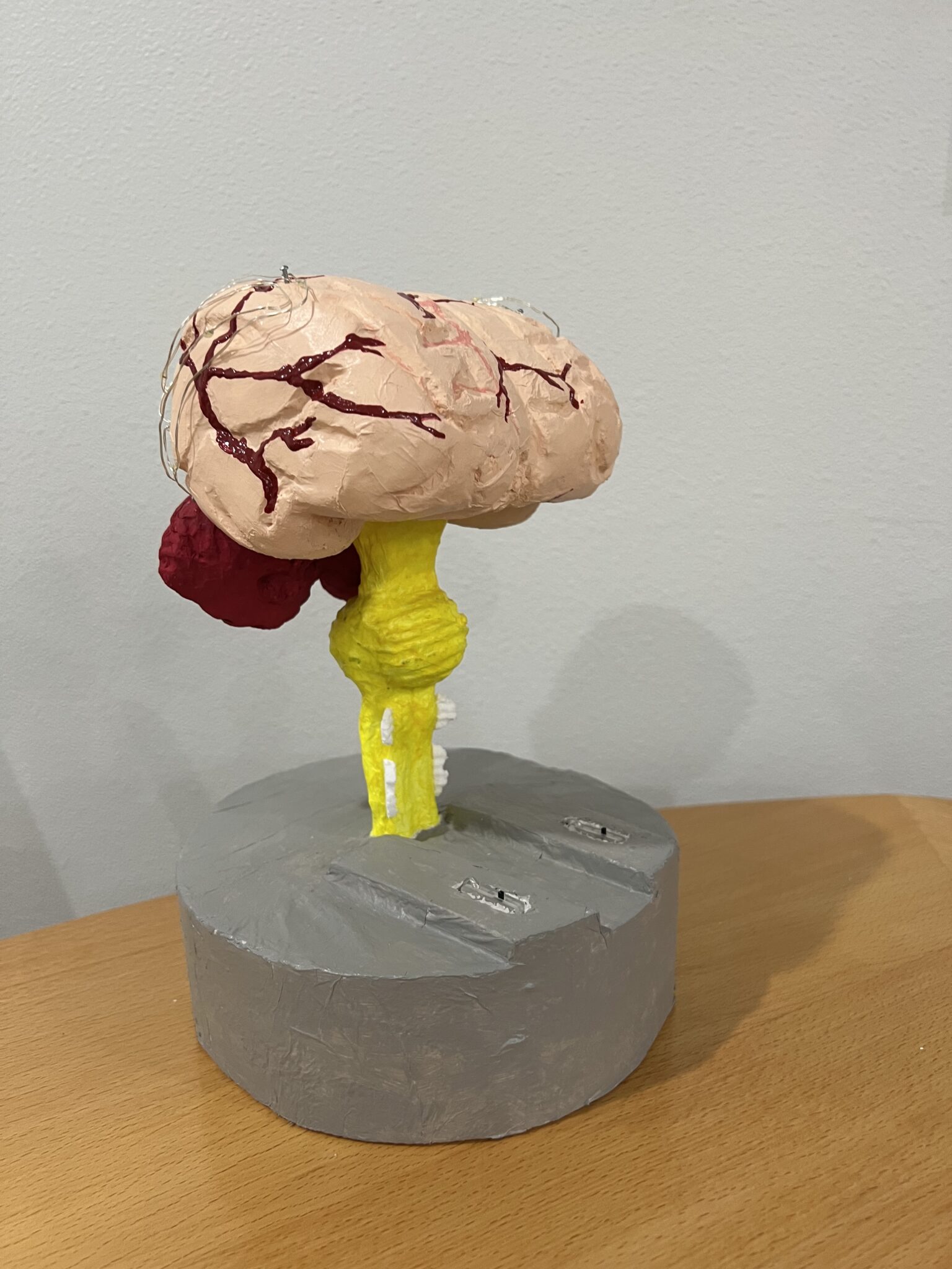 Mapping Brain Activity Of Language Comprehension For Dyslexic Vs. Non 