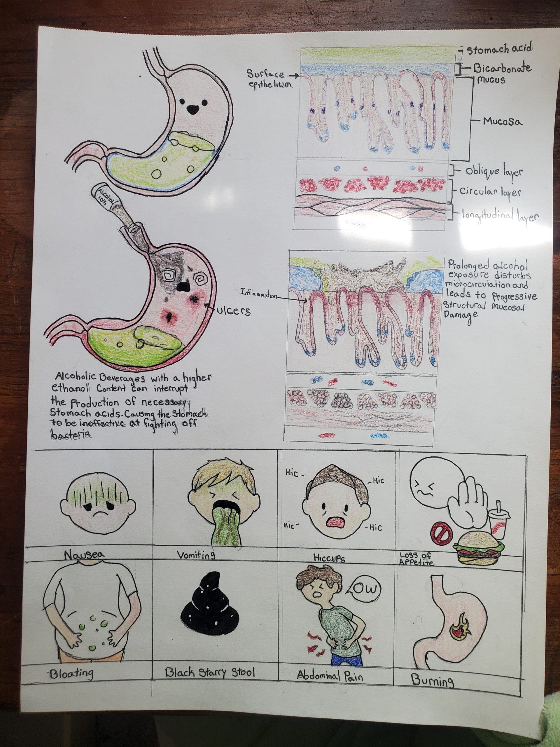 The Effects of Alcoholic Gastritis on the stomach mucosa – Human STEAM