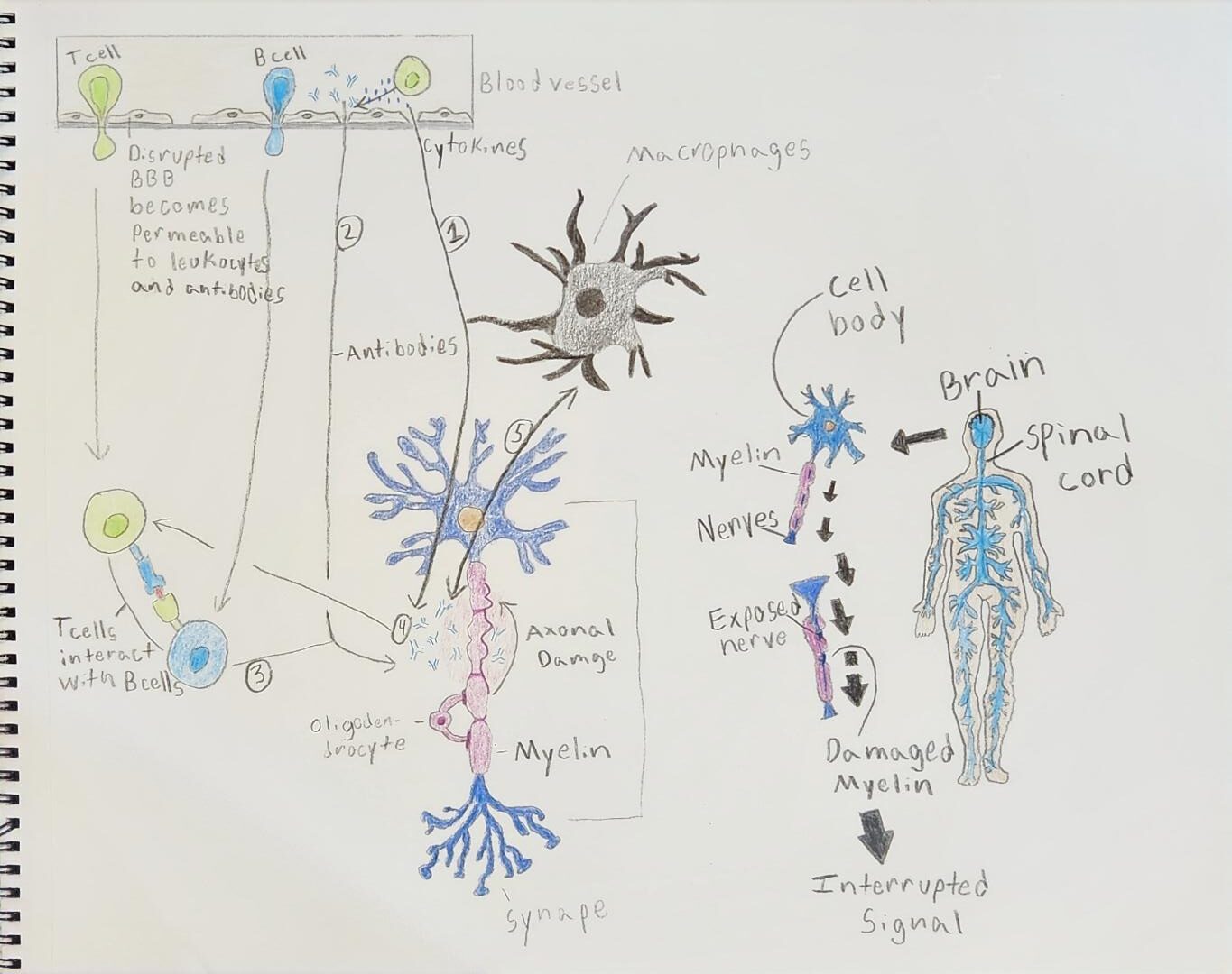 Role of cells and antibodies in Multiple Sclerosis.