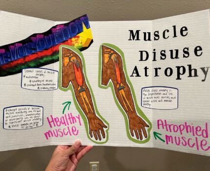 Muscle Disuse Atrophy: Cause and Prevention