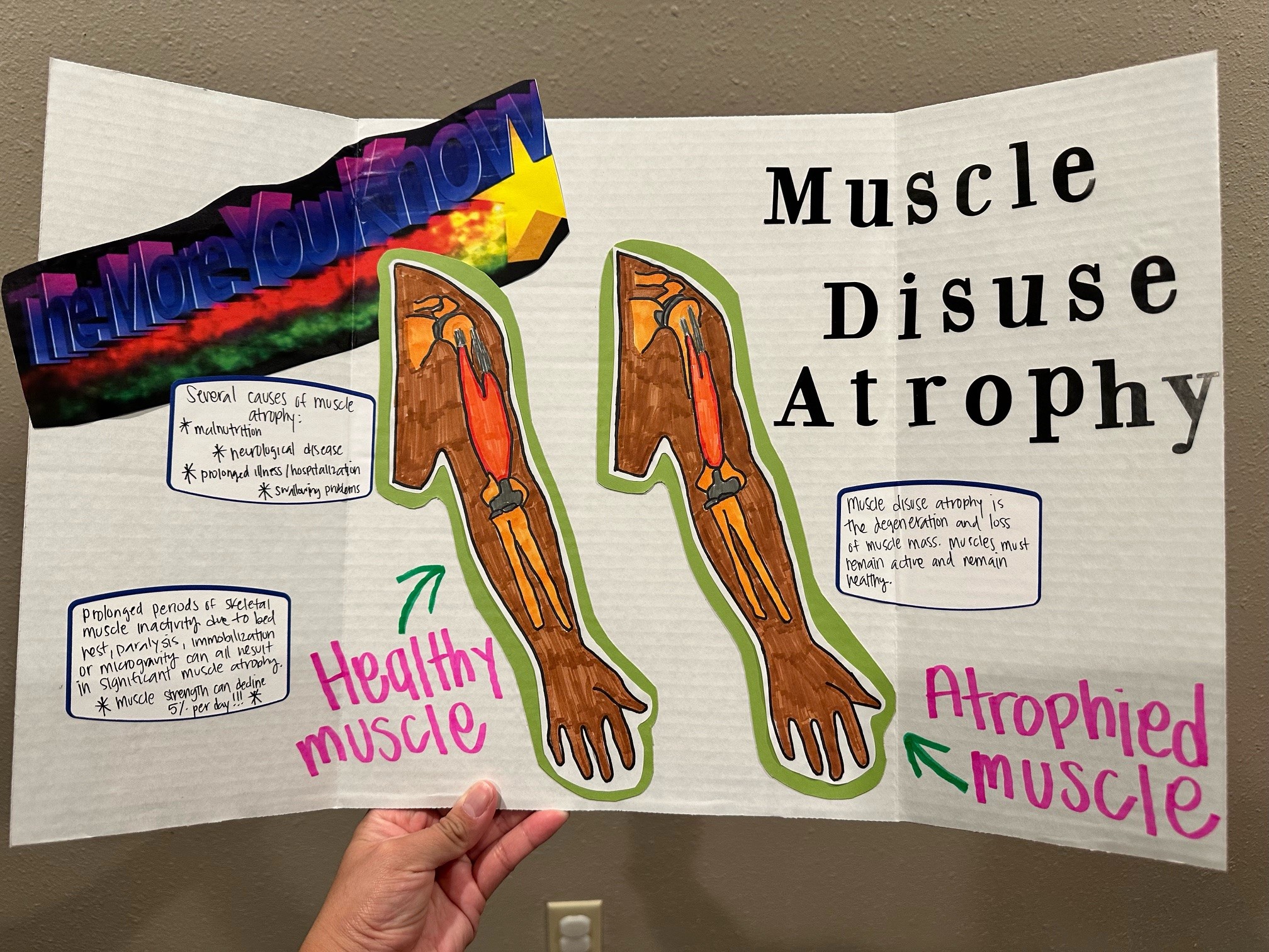 Muscle Disuse Atrophy: Cause and Prevention