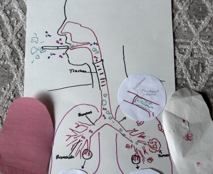 Lung Cancer- Jillian Muntz
